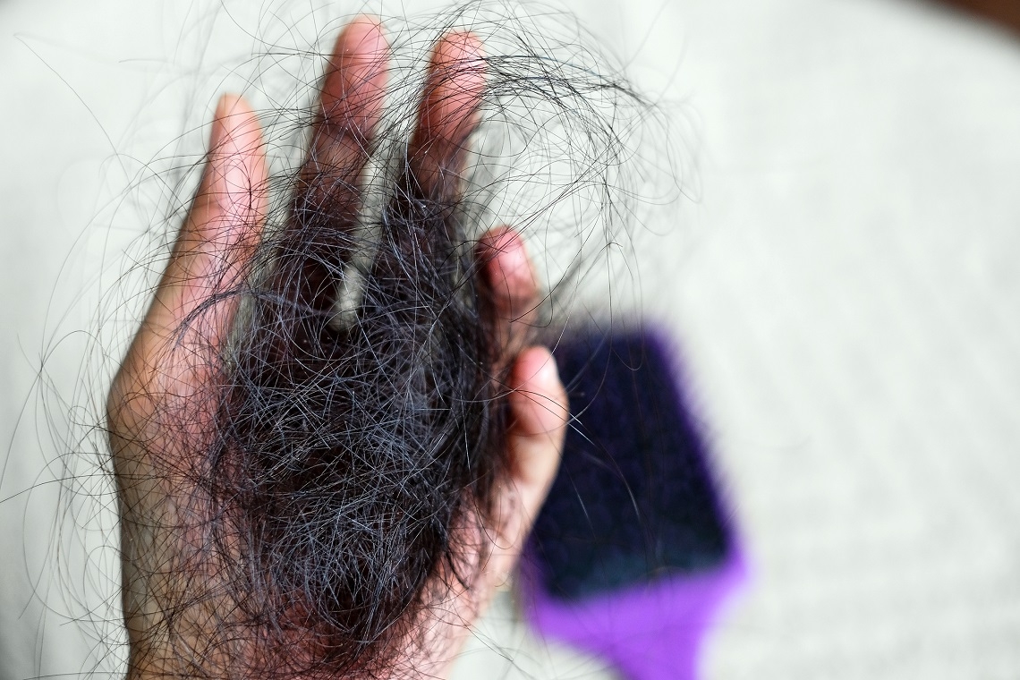 Come contrastare la caduta dei capelli: rimedi naturali e soluzioni con prodotti specifici