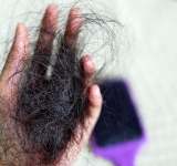 Come contrastare la caduta dei capelli: rimedi naturali e soluzioni con prodotti specifici